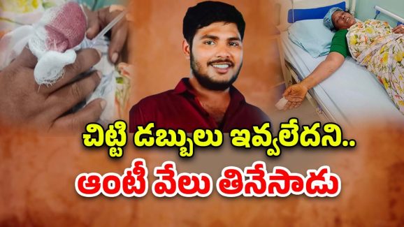 Hyderabad Crime: అరేయ్ ఏంట్రా ఇది! చిట్టి డబ్బులు ఇవ్వలేదని.. ఆంటీ వేలు కొరికి తినేసాడు