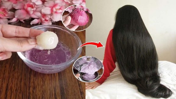 Onion Juice For Hair Growth: ఈ ఒక్కటి అప్లై చేస్తే.. జుట్టు వద్దన్నా పెరుగుతుంది