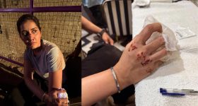 Tollywood Actress:హీరోయిన్ రాశీ ఖన్నాకు యాక్సిడెంట్.. ముక్కులో నుంచి బ్లడ్.. ఇప్పుడెలా ఉందంటే..?