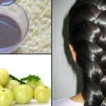 Amla For Hair Growth: ఉసిరి ఇలా వాడితే.. తల మోయలేనంత జుట్టు