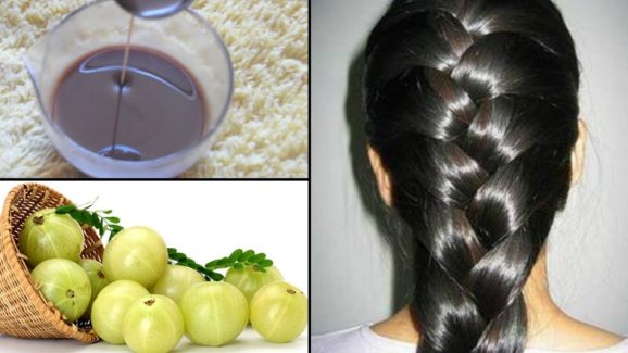 Amla For Hair Growth: ఉసిరి ఇలా వాడితే.. తల మోయలేనంత జుట్టు