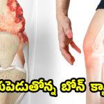 Bone Cancer Symptoms: బోన్ క్యాన్సర్.. ప్రారంభంలో కనిపించే లక్షణాలివే !