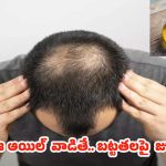 Rosemary Oil For Bald Head: బట్టతలపై కూడా జుట్టు పెరగాలంటే.. ఈ ఒక్క ఆయిల్ వాడితే చాలు