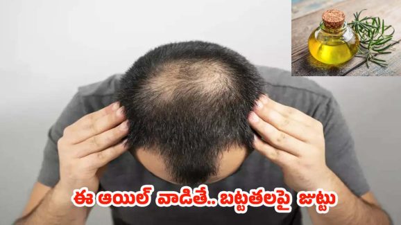 Rosemary Oil For Bald Head: బట్టతలపై కూడా జుట్టు పెరగాలంటే.. ఈ ఒక్క ఆయిల్ వాడితే చాలు