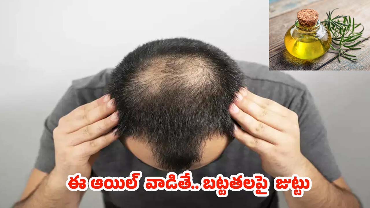 Rosemary Oil For Bald Head: బట్టతలపై కూడా జుట్టు పెరగాలంటే.. ఈ ఒక్క ఆయిల్ వాడితే చాలు