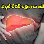 Fatty Liver Symptoms: పురుషుల్లో ఫ్యాటీ లివర్ సమస్య.. ఈ లక్షణాలుంటే చాలా డేంజర్