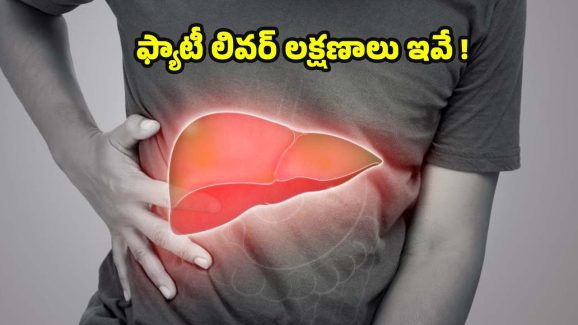 Fatty Liver Symptoms: పురుషుల్లో ఫ్యాటీ లివర్ సమస్య.. ఈ లక్షణాలుంటే చాలా డేంజర్
