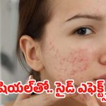 Facial Side Effects: ఫేషియల్‌‌‌తో.. ఈ సమస్యలు రావడం ఖాయం, జాగ్రత్త