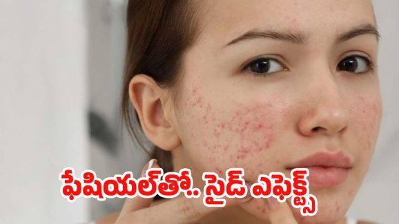 Facial Side Effects: ఫేషియల్‌‌‌తో.. ఈ సమస్యలు రావడం ఖాయం, జాగ్రత్త