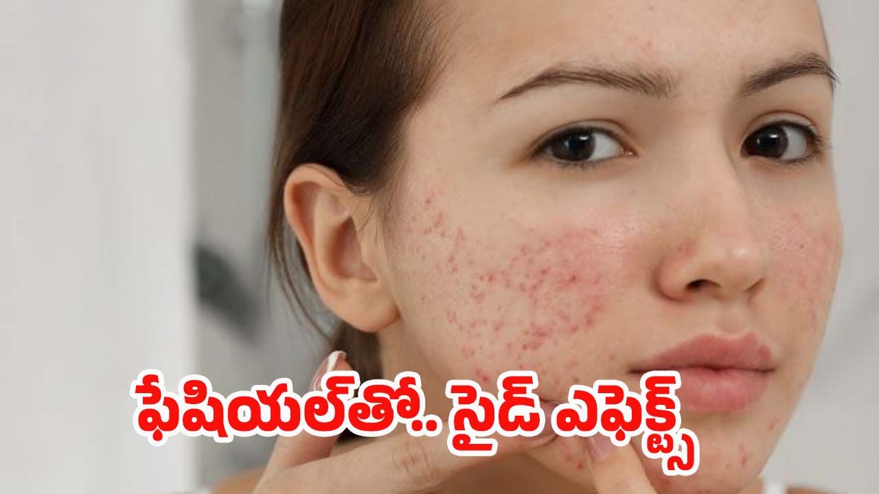 Facial Side Effects: ఫేషియల్‌‌‌తో.. ఈ సమస్యలు రావడం ఖాయం, జాగ్రత్త