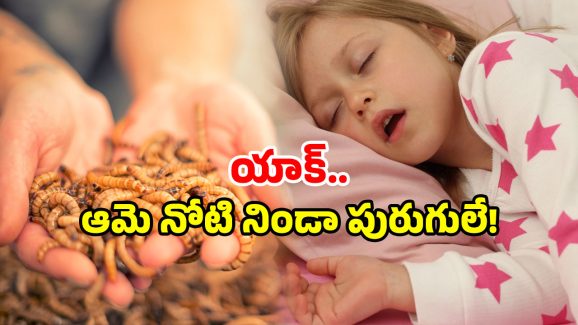 Bizarre Incident: బాలిక నోటి నుంచి బయటకొస్తున్న పురుగులు.. వారం రోజులుగా నరకం, ఏమైంది?