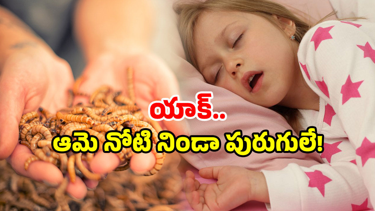 Bizarre Incident: బాలిక నోటి నుంచి బయటకొస్తున్న పురుగులు.. వారం రోజులుగా నరకం, ఏమైంది?
