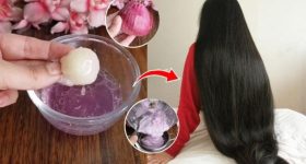 Onion Juice For Hair: ఊడిన చోటే కొత్త జుట్టు రావాలంటే.. ఉల్లిపాయ జ్యూసే కరెక్ట్ !