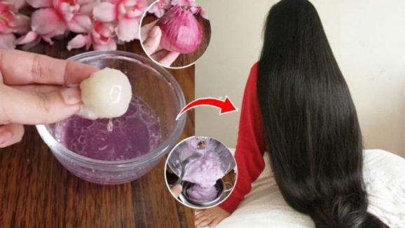 Onion Juice For Hair: ఊడిన చోటే కొత్త జుట్టు రావాలంటే.. ఉల్లిపాయ జ్యూసే కరెక్ట్ !
