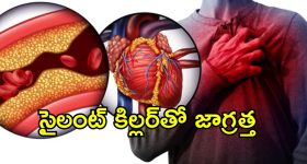 Hearth Healt CAD: గుండె అనారోగ్యానికి కొలెస్ట్రాల్ ఒక్కటే సమస్య కాదు.. తెలియని ప్రమాదకర కారణాలివే..