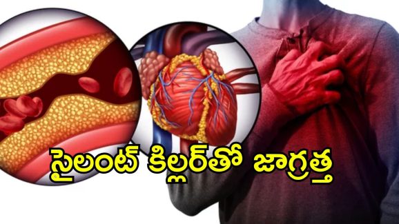 Hearth Healt CAD: గుండె అనారోగ్యానికి కొలెస్ట్రాల్ ఒక్కటే సమస్య కాదు.. తెలియని ప్రమాదకర కారణాలివే..