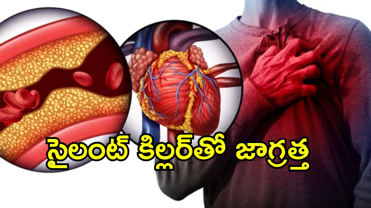 Hearth Healt CAD: గుండె అనారోగ్యానికి కొలెస్ట్రాల్ ఒక్కటే సమస్య కాదు.. తెలియని ప్రమాదకర కారణాలివే..