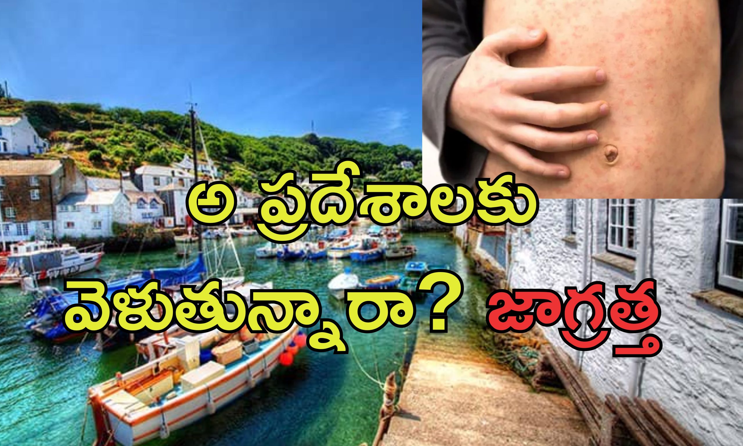 Holiday Spots Measles: హాలిడే స్పాట్స్‌లో మెదడు వాపు వ్యాధి ఇన్‌ఫెక్షన్ .. ఈ ప్రదేశాలకు వెళితే ప్రమాదం