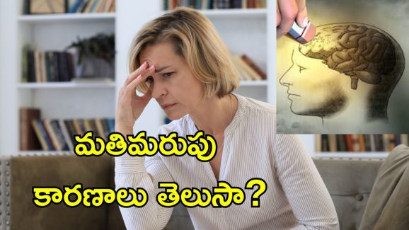 Alzheimer’s Memory Decline: మతిమరుపు, అల్జీమర్స్‌కు ఇవే కారణాలు.. మెదడు ఆరోగ్యానికి ప్రమాదకరం..