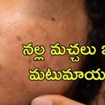 Dark Spots On Face: నల్ల మచ్చలు లేని మెరిసే చర్మం కావాలా.. ఈ జ్యూస్‌తో ఖర్చు లేకుండా
