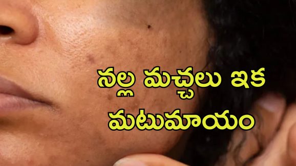 Dark Spots On Face: నల్ల మచ్చలు లేని మెరిసే చర్మం కావాలా.. ఈ జ్యూస్‌తో ఖర్చు లేకుండా