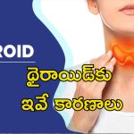 Women Thyroid Issues: మహిళల్లోనే థైరాయిడ్ సమస్య ఎక్కువ?.. జాగ్రత్తలు, చికిత్స ఇవే..