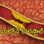 Arteries Block Ayurvedic Remedies: గుండె ధమనుల్లో పూడికలు ప్రాణాంతకం.. ఆయుర్వేద టిప్స్‌తో ఇలా క్లీన్ చేసుకోండి