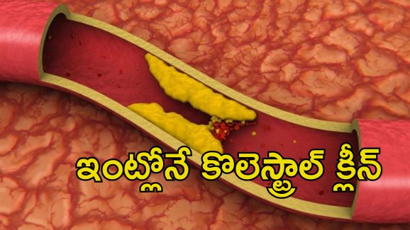 Arteries Block Ayurvedic Remedies: గుండె ధమనుల్లో పూడికలు ప్రాణాంతకం.. ఆయుర్వేద టిప్స్‌తో ఇలా క్లీన్ చేసుకోండి