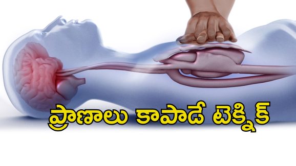 Heart Attack CPR: గుండె పోటు వస్తే వెంటనే సిపిఆర్ చేయాలి.. ఎలా చేయాలో తెలుసా?