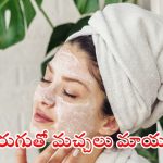 Curd For Pigmentation: ముఖంపై మంగు మచ్చలా ? పెరుగు ఇలా వాడితే.. ప్రాబ్లమ్ సాల్వ్
