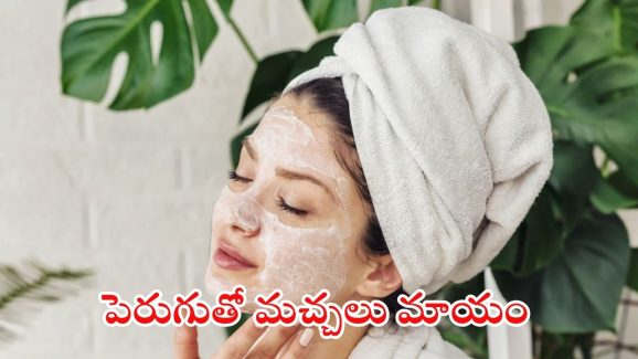 Curd For Pigmentation: ముఖంపై మంగు మచ్చలా ? పెరుగు ఇలా వాడితే.. ప్రాబ్లమ్ సాల్వ్
