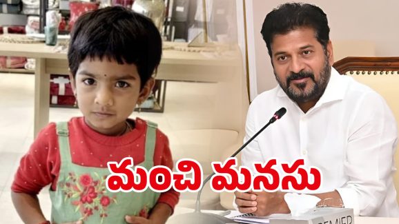 CM Revanth Reddy: సీఎం రేవంత్ మంచి మనసు.. నాలుగేళ్ల చిన్నారికి ఉచిత వైద్యానికి ఆదేశాలు