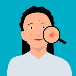 Acne: మొటిమలు, వాటి వల్ల వచ్చే గుంతలను తగ్గించే సాలిసిలిక్ యాసిడ్, దీన్ని ఎలా అప్లై చేయాలంటే
