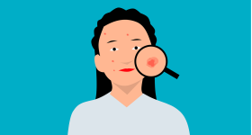Acne: మొటిమలు, వాటి వల్ల వచ్చే గుంతలను తగ్గించే సాలిసిలిక్ యాసిడ్, దీన్ని ఎలా అప్లై చేయాలంటే