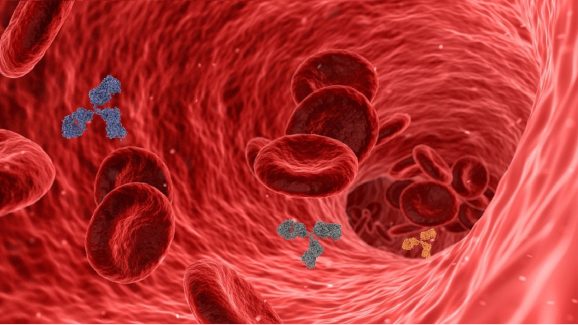 Reduce cholesterol:  శరీరంలో ఉన్న కొలెస్ట్రాల్ తగ్గించడానికి సింపుల్ ఆయుర్వేద చిట్కాలు ఇవిగో