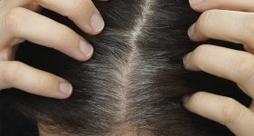 Remedies for white hair: తెల్ల జుట్టు పూర్తిగా పోయి నల్లగా మార్చే చిట్కా ఇదే..