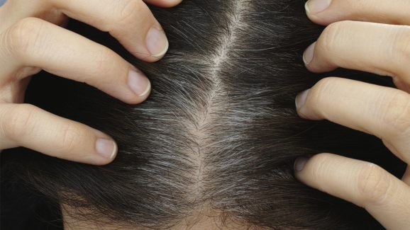 Remedies for white hair: తెల్ల జుట్టు పూర్తిగా పోయి నల్లగా మార్చే చిట్కా ఇదే..