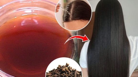 Best Hair Serum: జుట్టు రాలడాన్ని తగ్గించే.. బెస్ట్ హెయిర్ సీరం