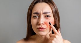 Tips For Sensitive Skin: సెన్సిటివ్ స్కిన్‌తో ఇబ్బంది పడుతున్నారా ? ఈ టిప్స్ పాటిస్తే బెస్ట్ రిజల్ట్
