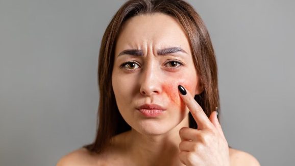 Tips For Sensitive Skin: సెన్సిటివ్ స్కిన్‌తో ఇబ్బంది పడుతున్నారా ? ఈ టిప్స్ పాటిస్తే బెస్ట్ రిజల్ట్