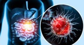 Cancer: క్యాన్సర్ ఏ అవయవాలకు త్వరగా వ్యాపిస్తుందో తెలుసా ?