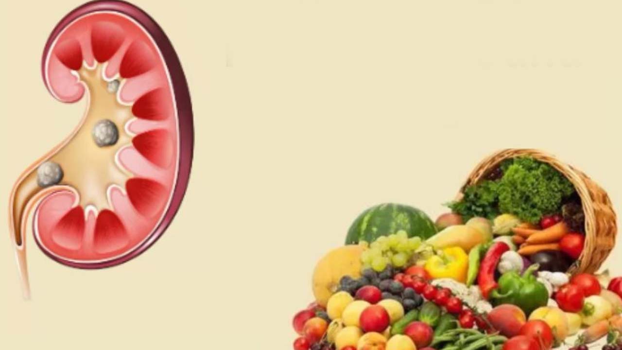 Kidney Stones: కిడ్నీ స్టోన్స్ ఉన్న వాళ్లు..  వీటిని పొరపాటున కూడా తినొద్దు !