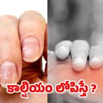 Calcium Deficiency: మీలో ఈ లక్షణాలున్నాయా ? అస్సలు లైట్ తీసుకోవద్దు !