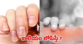 Calcium Deficiency: మీలో ఈ లక్షణాలున్నాయా ? అస్సలు లైట్ తీసుకోవద్దు !