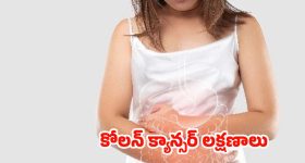 Dried Dates: రోజూ ఎండు ఖర్జూరాలు తింటే.. బోలెడు లాభాలు !