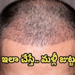 Hair Regrowth: సర్జరీ, మందులు లేకుండానే హెయిర్ గ్రోత్.. గుడ్ న్యూస్ చెప్పిన శాస్త్రవేత్తలు