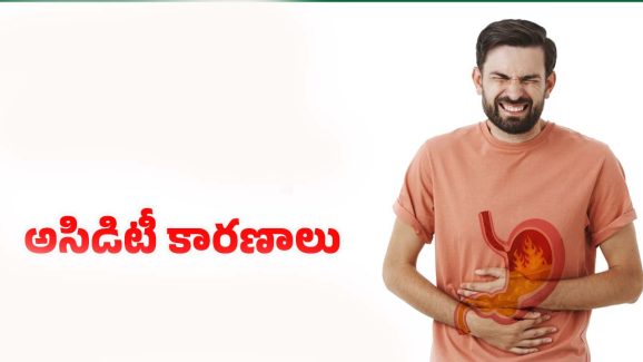 Acidity Causes: అసిడిటీకి కారణాలు.. నివారణ మార్గాలు !