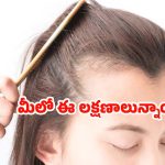 Vitamin D: మీలో ఈ లక్షణాలున్నాయా ? అయితే విటమిన్ డి లోపించినట్లే.. !