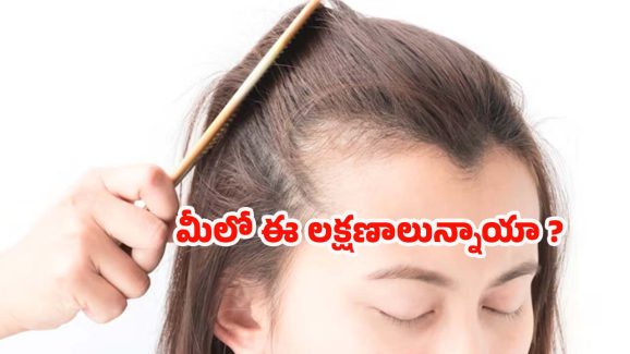 Vitamin D: మీలో ఈ లక్షణాలున్నాయా ? అయితే విటమిన్ డి లోపించినట్లే.. !