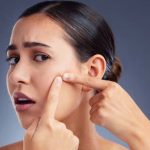 Pimple Free Skin: ఈ టిప్స్ పాటిస్తే.. మొటిమలు మాయం